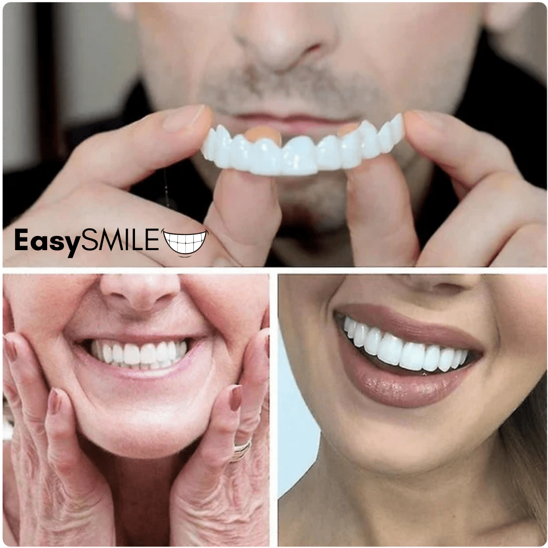 EasySmile | Carillas dentales de cerámica adaptables - GoMart!
